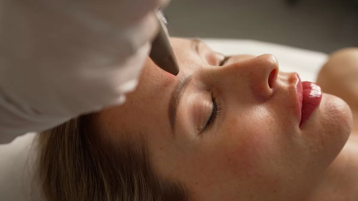 woman receiving fractional laser treatment after BLT cream is applied